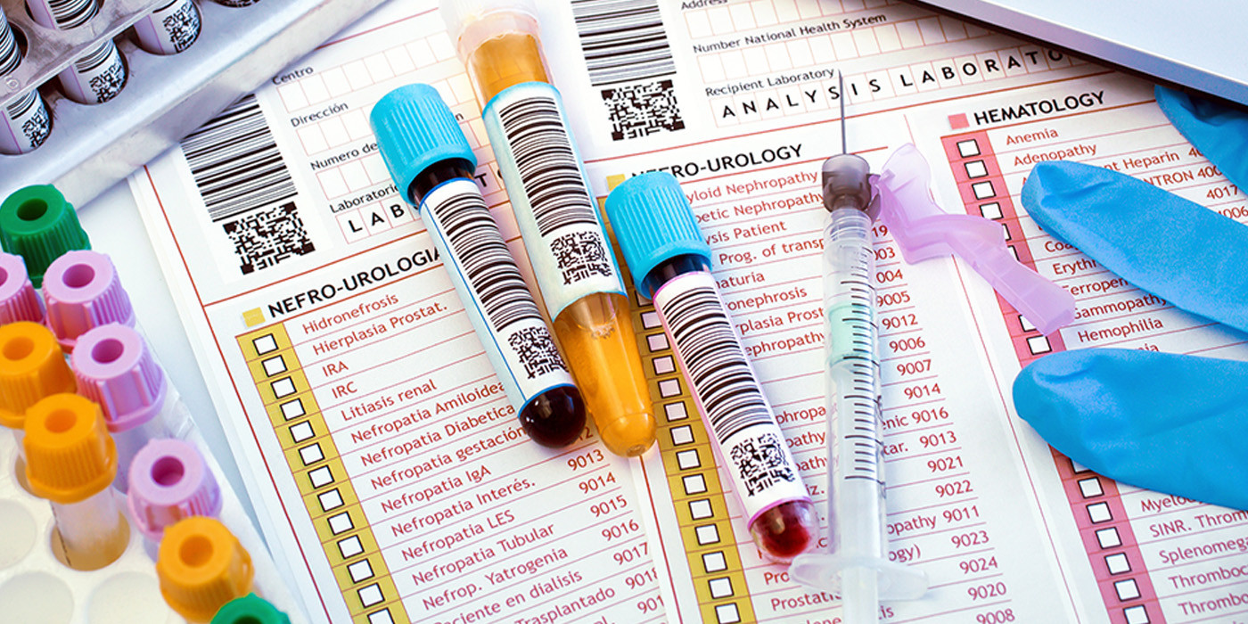 Test tubes with colored caps and a syringe placed on labeled lab forms showing hematology and uro‑urology checklists, with a gloved hand holding paperwork
