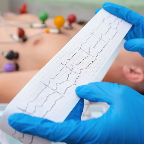 Gloved hands hold a printed ECG strip while a patient with chest electrodes lies in the background on a table.