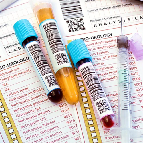 Test tubes with colored caps and a syringe placed on labeled lab forms showing hematology and uro‑urology checklists, with a gloved hand holding paperwork
